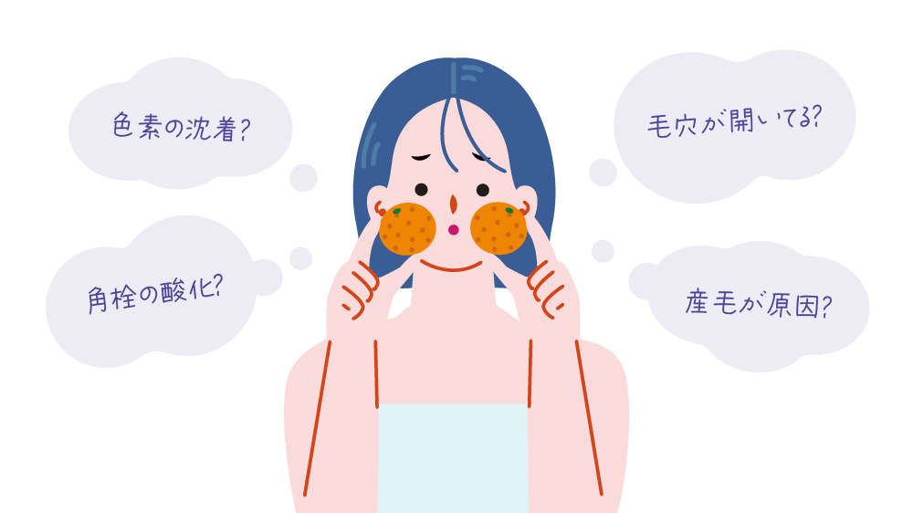毛穴の黒ずみの主な原因