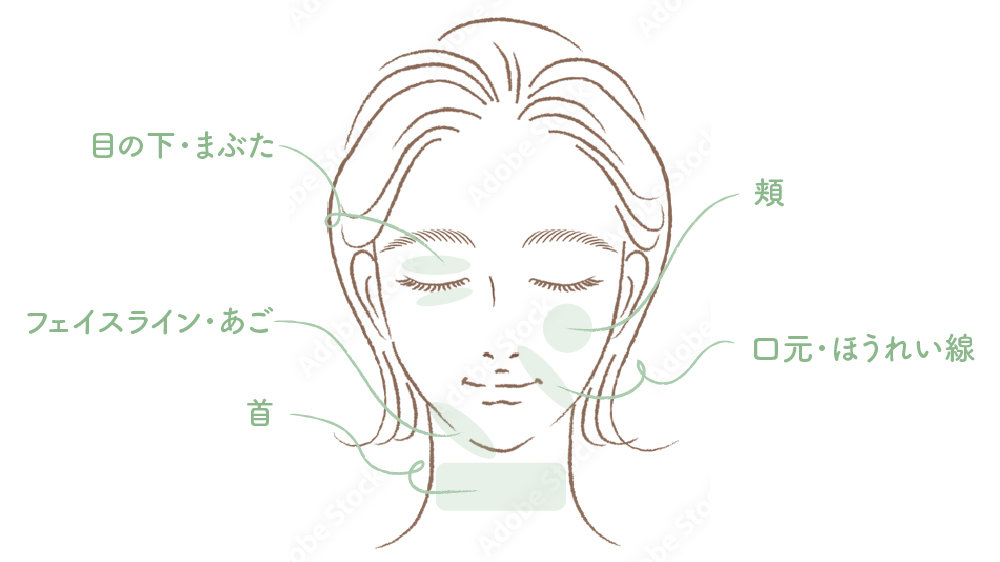 たるみが出やすい顔の部位