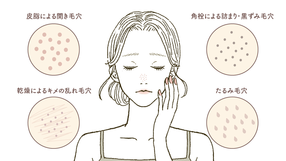 開き毛穴の種類